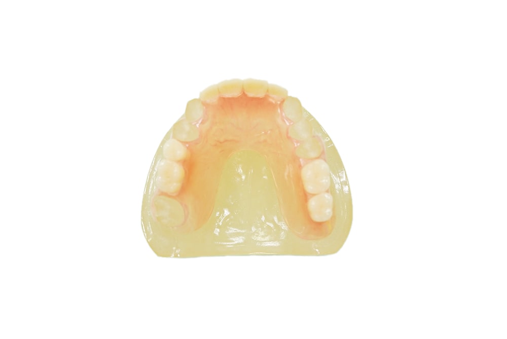 ノンクラスプデンチャー